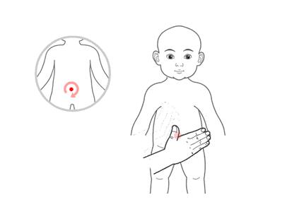 小兒推拿治療感冒嗎？